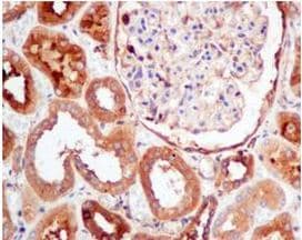 Pkm Antibody Epr10139 Ab154816  Immunohistochemistry Formalin Pfa Fixed Paraffin Embedded Sections Img48356