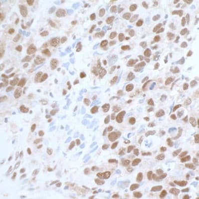 Anti-CARM1 antibody(AB245467)