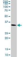 Cenph Antibody Ab88593  Western Blot Img147163