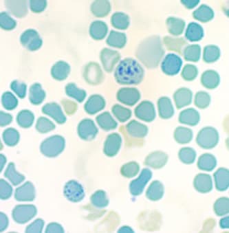 Brilliant Cresyl Blue Solution (1.5%)(ab246814)