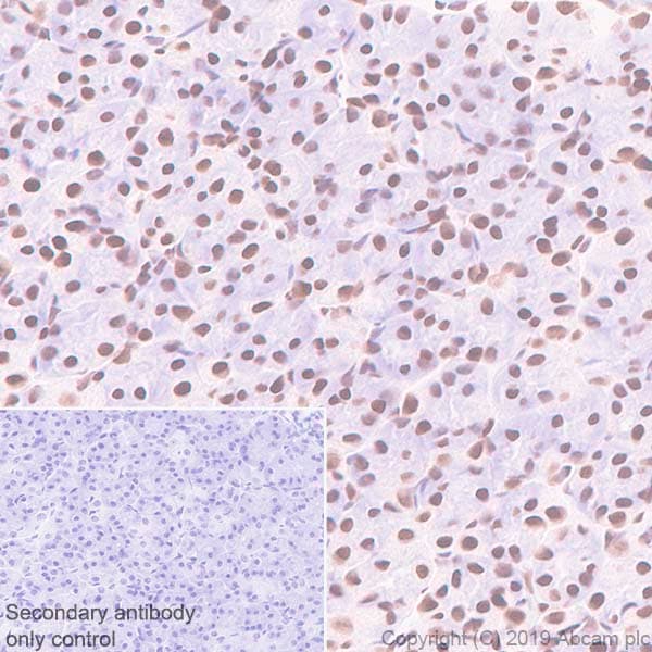 Anti-BRG1 antibody [EPR3912](AB108318)