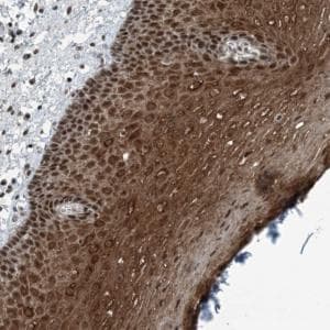 Anti-YTHDC1 antibody(AB122340)