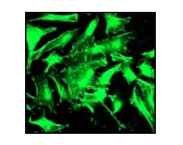 Anti-ACTC1 antibody [EP184E](AB46805)