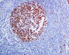 Tacc3 Antibody Epr7756 Bsa And Azide Free Ab224525  Immunohistochemistry Formalin Pfa Fixed Paraffin Embedded Sections Img113443
