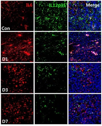Anti-IL-6 antibody(AB6672)