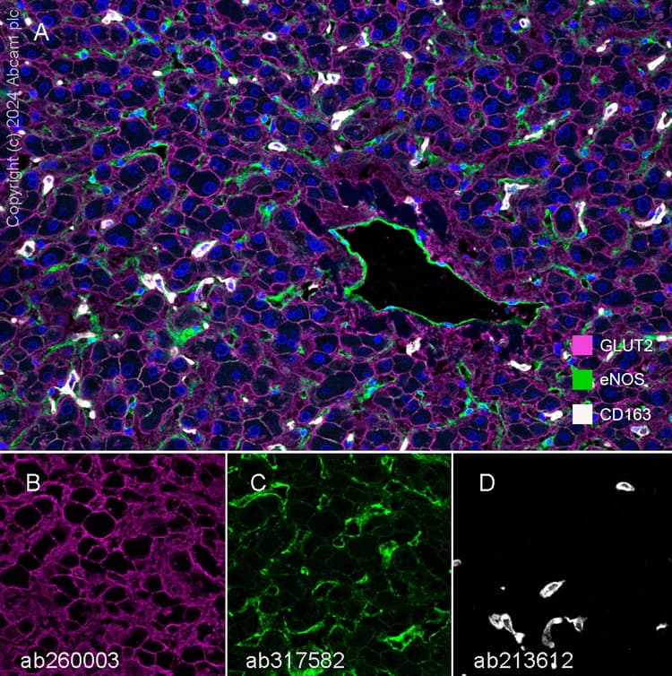 Anti-Glucose Transporter GLUT2 antibody [EPR22946-74](AB234440)