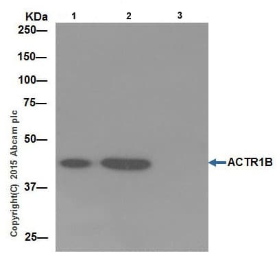Actr1b Antibody Epr16969 Bsa And Azide Free Ab251406  Immunoprecipitation Img8458