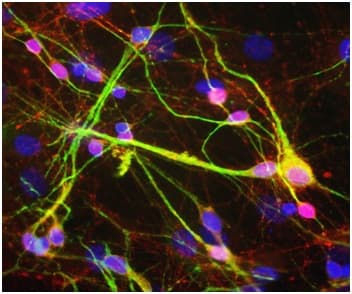 Anti-Alpha-synuclein antibody(AB190376)