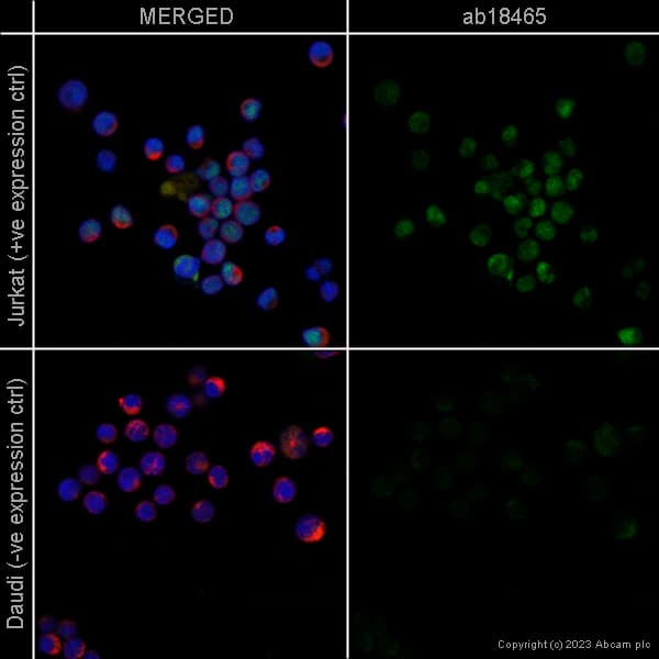 Anti-beta Tubulin antibody - Loading Control(AB6046)
