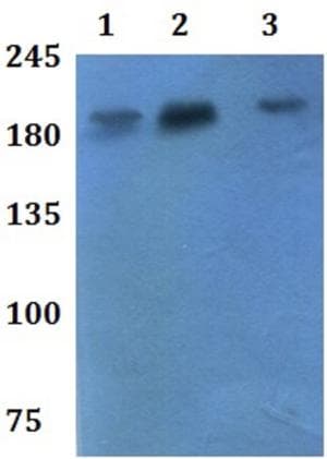 Anti-ADAMTS7 antibody(AB201083)
