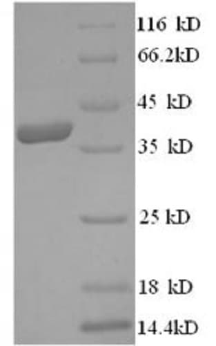 Recombinant Human HMGCR protein (His tag)(AB235714)