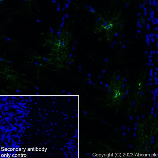 Anti-GPCR GPR17 antibody [EPR26423-34](AB316105)