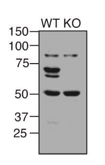 Anti-NF-kB p65 antibody [E379](AB32536)