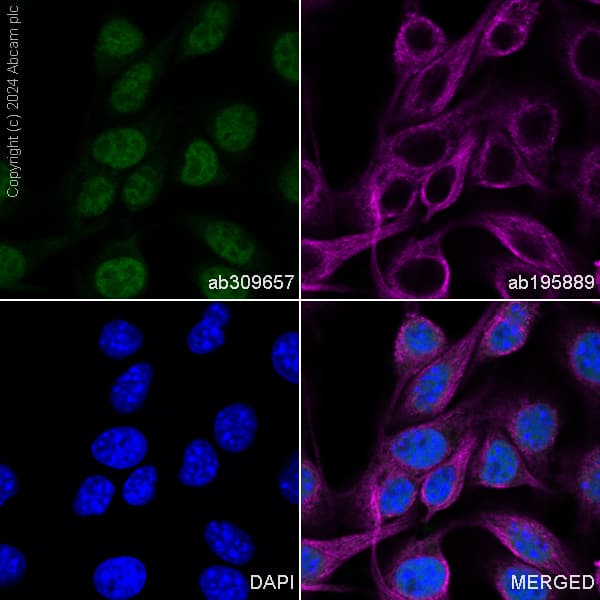 Alexa Fluor® 488 Anti-SOX10 antibody [EPR4007](AB309657)