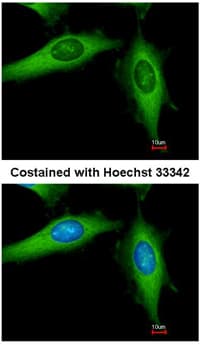 Diaph1 Antibody Ab96784  Immunocytochemistry Immunofluorescence Img121036