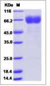 Ab276625  Sds Page Img68909