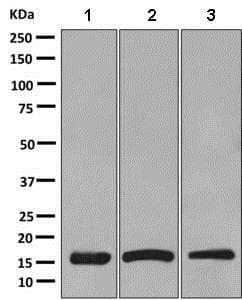 Sdhc Antibody Epr11035b Ab155999  Western Blot Img126022