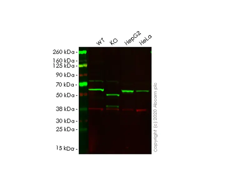 Anti-SQSTM1 / p62 antibody [EPR4844] - Autophagosome Marker(AB109012)