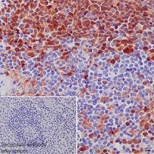 Syk Antibody Ep573y Ab40781  Immunohistochemistry Formalin Pfa Fixed Paraffin Embedded Sections Img3164