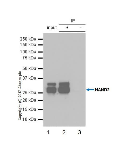 Anti-HAND2 antibody [EPR19451](AB200040)