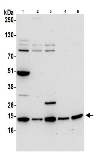 Arpc4 Antibody Ab217065  Western Blot Img130408