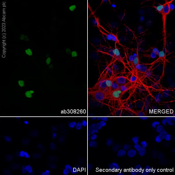 Arx Antibody Epr27481 32 Ab308260  Immunocytochemistry Immunofluorescence Img408873