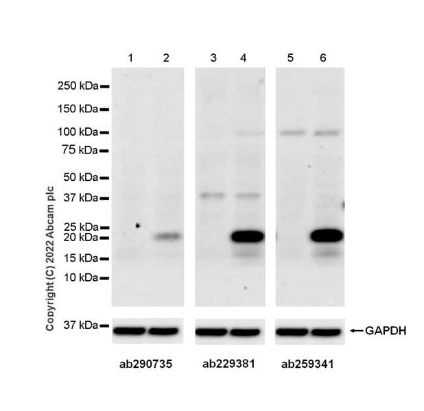 Anti-IL-6 antibody [EPR23819-103](AB290735)