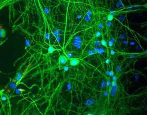 Anti-CCR7 antibody [4B12](ab52602)