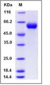 Recombinant Human Antithrombin III/ATIII protein (His tag)(AB276207)