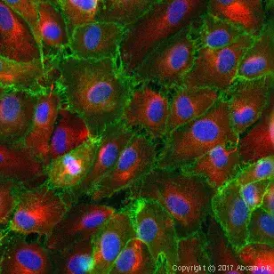 Anti-CD31 antibody [JC/70A](AB9498)