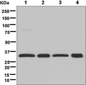Gc1q R Antibody Epr8870 Ab134926  Western Blot Img116326