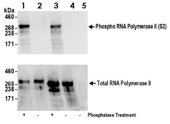 Anti-RNA polymerase II CTD repeat YSPTSPS (phospho S2) antibody(ab70324)
