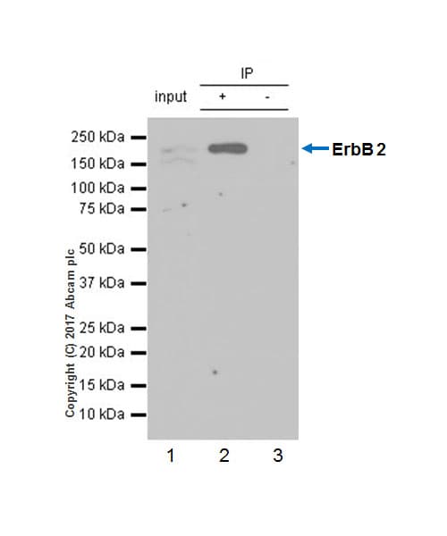 Anti-ErbB2 / HER2 antibody [EP1045Y](AB134182)