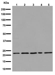 Lhfpl5 Antibody Epr16285 C Terminal Ab192242  Western Blot Img103155