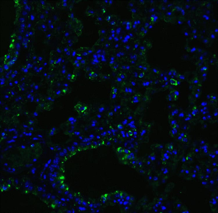 Anti-ACE2 antibody(AB15348)