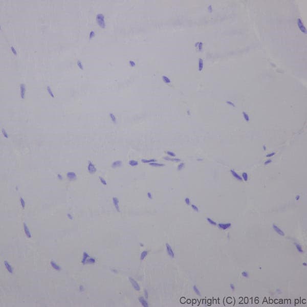 Anti-Cardiac Troponin T antibody [EPR20266] - BSA and Azide free(AB223536)