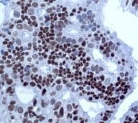 Chd3 Antibody Epncir110a Bsa And Azide Free Ab240942  Immunohistochemistry Formalin Pfa Fixed Paraffin Embedded Sections Img77072