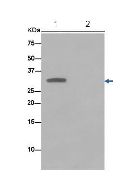 Anti-EXOSC3 antibody [EPR14840(B)] - N-terminal(AB184961)