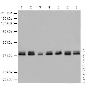 Anti-ERK1 + ERK2 antibody [EPR17526](AB184699)