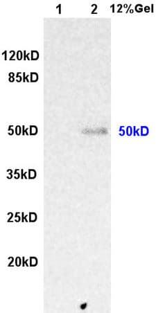 Integrin Linked Ilk Antibody Ab217025  Western Blot Img153932