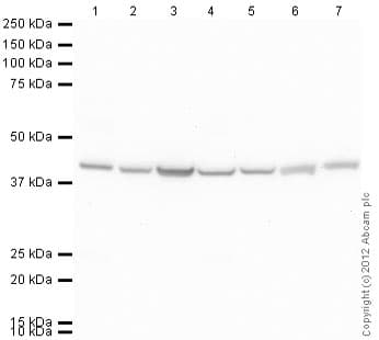 Alpha Skeletal Muscle Actin Antibody 337ct 30101 Loading Control Ab88226  Western Blot Img121699