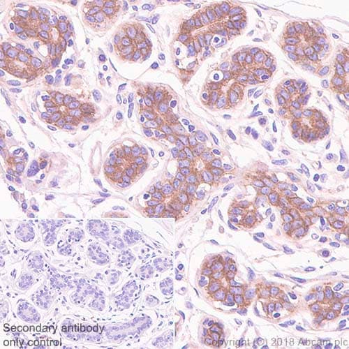 Cd276 Antibody Sp206 Ab227670  Immunohistochemistry Formalin Pfa Fixed Paraffin Embedded Sections Img130329