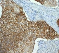 Anti-Glucose Transporter GLUT1 antibody [EPR3915] - BSA and Azide free(AB252403)