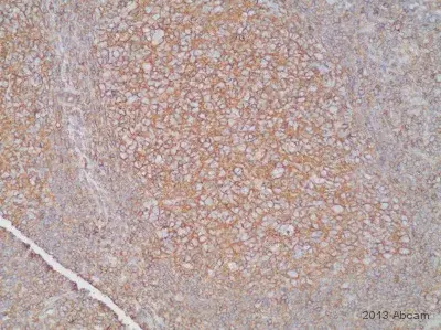 Anti-HLA A antibody [EP1395Y](AB52922)