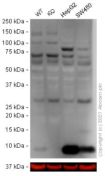 Anti-S100P antibody [EPR6142](AB124743)