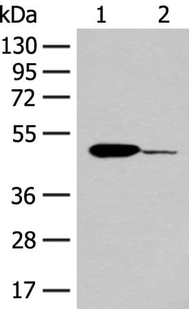 Anti-IRG1 antibody(AB222417)