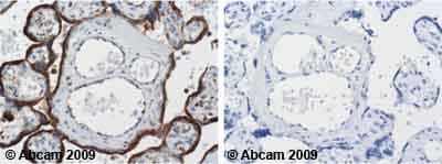 Anti-LAMP1 antibody [H4A3](ab25630)