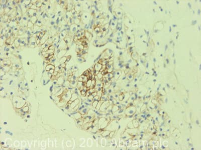 Plasma Membrane Marker (Na/K ATPase, pan Cadherin, PMCA1) Antibody Sampler Panel - Human, Mouse(AB254025)