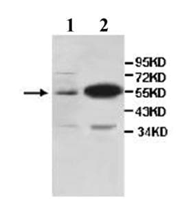 Cd14 Antibody Ab106285  Western Blot Img16382