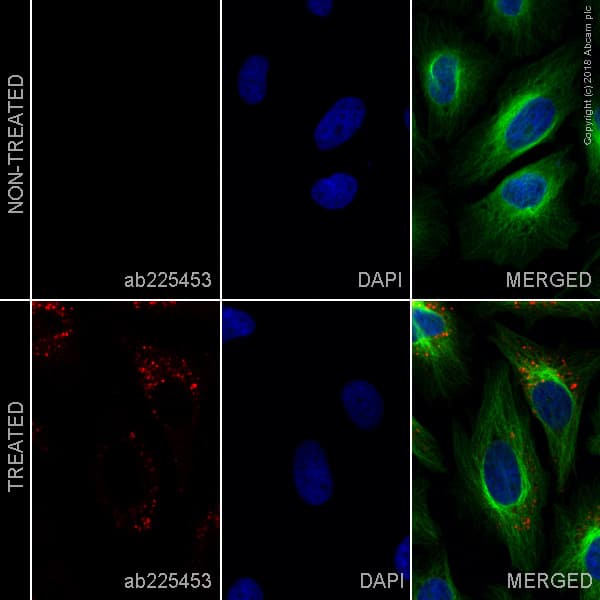 Alexa Fluor® 647 Anti-SQSTM1 / p62 antibody [EPR18351](AB225453)